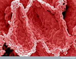 alveoli in the lung