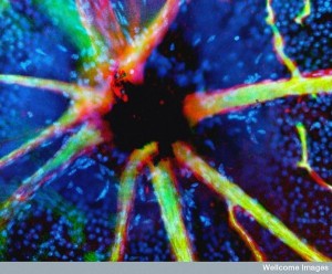 blood vessels emerging from the optic nerve