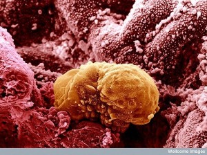 coloured image of a 6 day old human embryo implanting