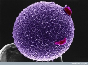 human egg with coronal cells