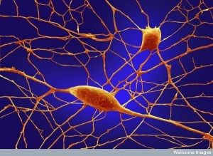 purkinje neurons