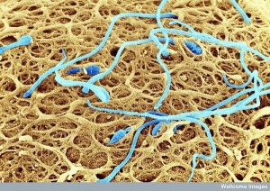 sperm on the surface of a human egg