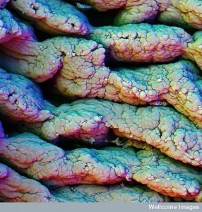 villi of small intestine
